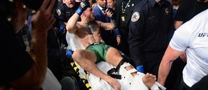 Conor McGregor si vážně poranil nohu