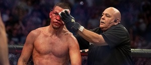 Eye poke je poměrně častým porušením MMA pravidel